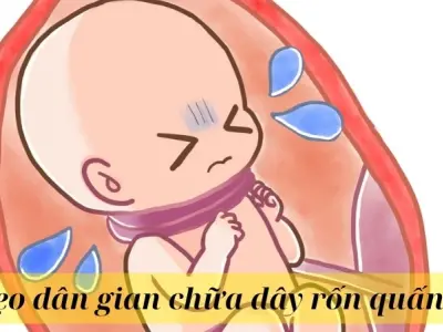 Mẹo dân gian chữa dây rốn quấn cổ giúp mẹ bầu an tâm sinh nở