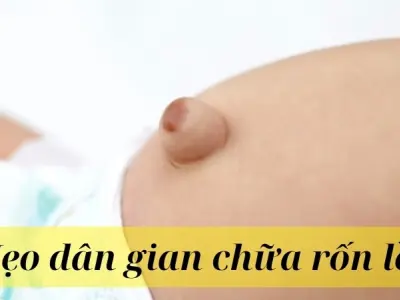 Mẹo dân gian chữa rốn lồi được nhiều mẹ bỉm tin dùng