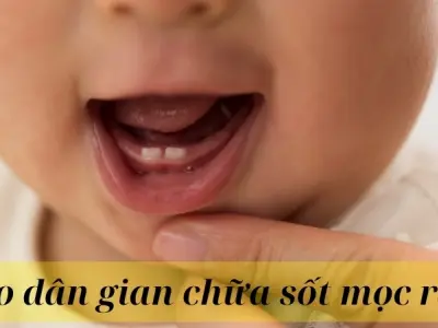 Mẹo dân gian chữa sốt mọc răng giúp bé giảm đau nhanh chóng
