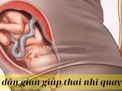 Mẹo dân gian giúp thai nhi quay đầu dễ sinh thường hơn