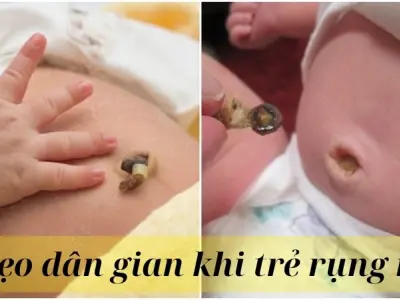 Những mẹo dân gian khi trẻ rụng rốn an toàn và nhanh khô rốn
