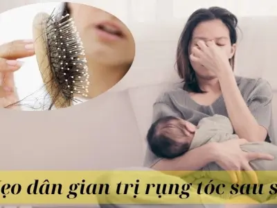 Mẹo dân gian trị rụng tóc sau sinh từ thảo dược quen thuộc