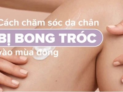 12 Mẹo Chữa Bong Da Chân Tại Nhà Đơn Giản, Hiệu Quả