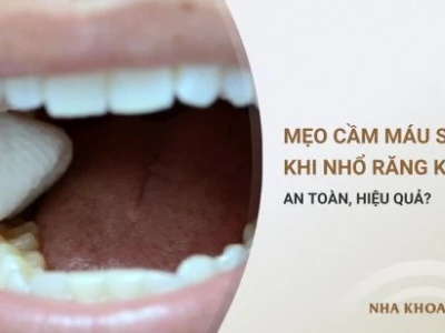 Mẹo cầm máu sau nhổ răng hiệu quả và an toàn tại nhà