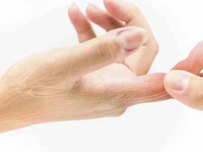 Mẹo Chữa Bong Gân Ngón Tay Cái: Hướng Dẫn Chi Tiết