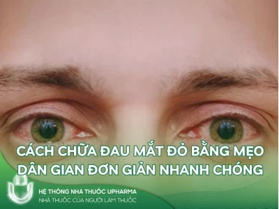 Mẹo Trị Đau Mắt Đỏ Hiệu Quả và Nhanh Khỏi Tại Nhà Năm 2026