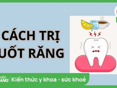 Mẹo Vặt Chữa Ê Buốt Răng Tại Nhà Hiệu Quả An Toàn